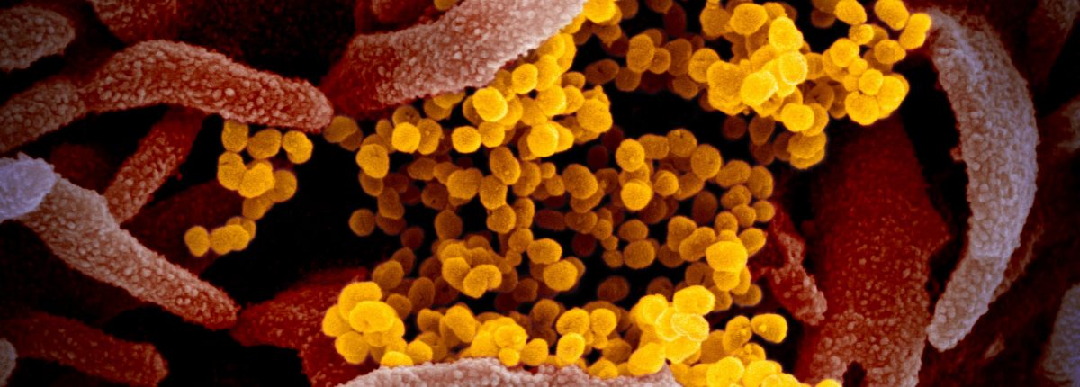 Tako je videti virus COVID-19 pod mikroskopom 