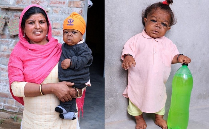 Odrasli Indijanec s telesom šestmesečnega otroka