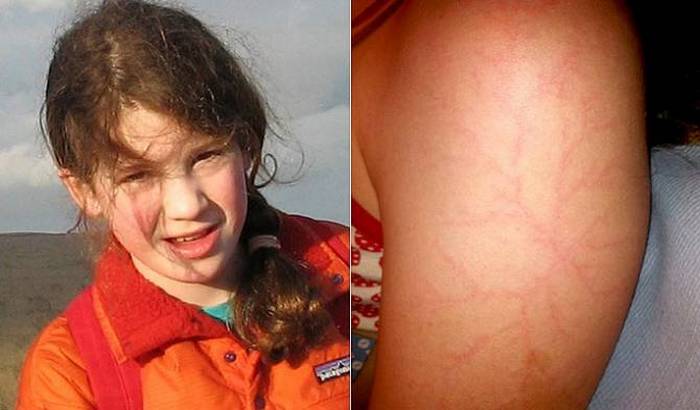 Skrivnostne risbe na koži Rusov